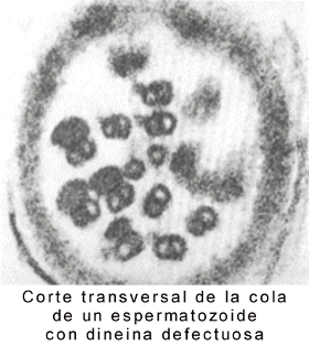 Fig. 6.10 (b) Microfotografías electrónicas del flagelo de un espermatozoide normal y con dineína defectuosa